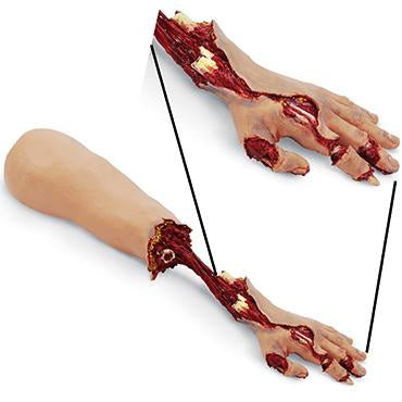 Nasco Healthcare Xtreme Trauma Bleeding Arm Add-On for SMART