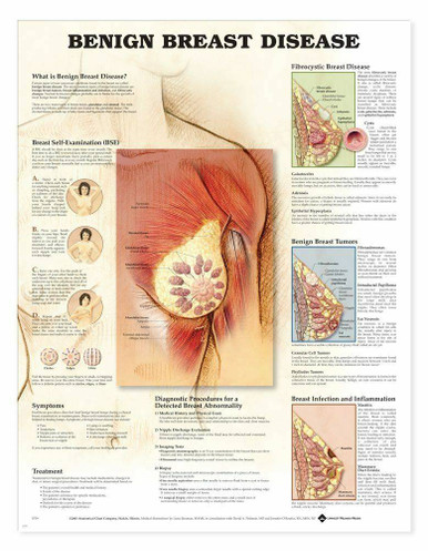  Female Breast Chart - Anatomy, Pathology And  Self-Examination : Learning: Science