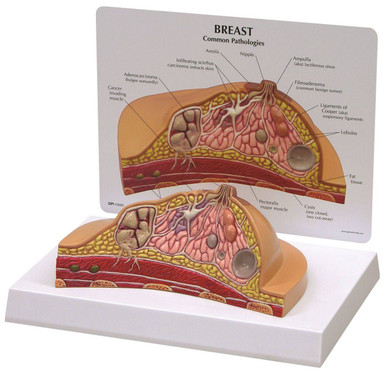 Anatomy Model Breast Cross Section