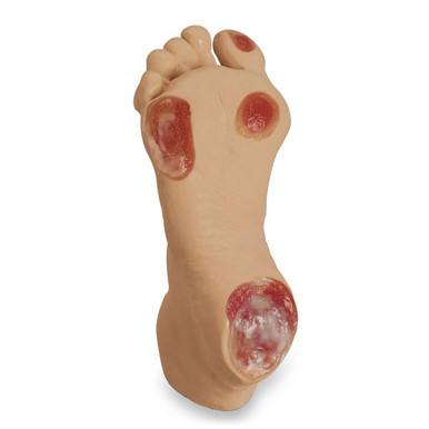 Nasco Healthcare Elderly Pressure Ulcer Foot - Light