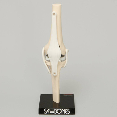 Modular Knee Model Sawbones Total Knee Modular Demonstrator | Anatomy Warehouse