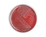 Oxoid™ Xlt-4 Agar 90mm Pre-Poured Plates