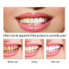 LANBENA Teeth Whitening Product Cleaning Essence Powder Serum Removes Plaque Stains Smile Tooth Dental Tools