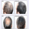 Toppik 27.5g Hair Fiber Thinning Concealer Loss Baldness Instant Refill Keratin Fiber Hair Powder 9colors