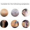 Laser Freckle Removal Instruments Skin Mole Removal Tool Dark Spot Cleaner Wart Tag Tattoo Removal Pen