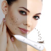 Laser Freckle Removal Instruments Skin Mole Removal Tool Dark Spot Cleaner Wart Tag Tattoo Removal Pen