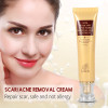 30g Women Skin Scar and Acne Mark Removal Gel Face Body Ointment Acne Postpartum Scar Repair Cream Skin Care TSLM2