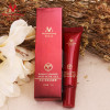 High Quality Herbal Cleansing Face Anti acne treatment cream Herbal scar removal oily skin Acne Spots skin care face