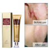 LANBENA ginseng extract against black dots cream scar removal facial blackhead acne skin care treatment bleaching cream 30ml 