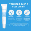 LANBENA EGF Anti Acne Against Black Dots Cream Scar Removal Facial Blackhead Acne Repair Skin Care Treatment LANBENA EGF Anti Acne Against Black Dots Cream Scar Removal Facial Blackhead Acne Repair Skin Care Treatment