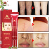 Scar Repair Cream Skin Care Natural Acne Remove Burn Stretch Marks Scar Removal Facial Body Skin Care Repair Cream