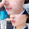 ISILANDON Acne Cleaning Cream Blackhead Skin Care Remove Repair Comedone Pimple Acne Quickly Face Acne Cream Remover Anti Acne