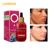 LANBENA Whitening Face Essence Oil Vitamin C Serum Remover Speckle Fade Dark Spots And Firming Face Serum Anti Wrinkle Skin Care