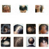 ReGrow - 7 Day Ginger Germinal Hair Growth Serum Essence Oil Hair Loss Building Loss Treatement Growth Hair for Men Women 