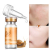 Daralis Snail Face Serum Essence Acne Treatment Blackhead Remover Whitening Moisturizing Ageless Anti-wrinkle Cream Skin Care