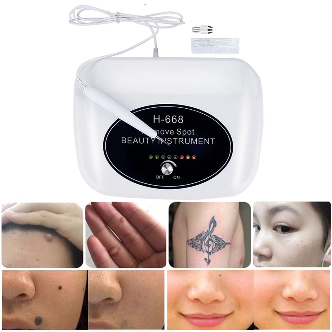 Update more than 76 neatcell tattoo removal reviews latest  thtantai2
