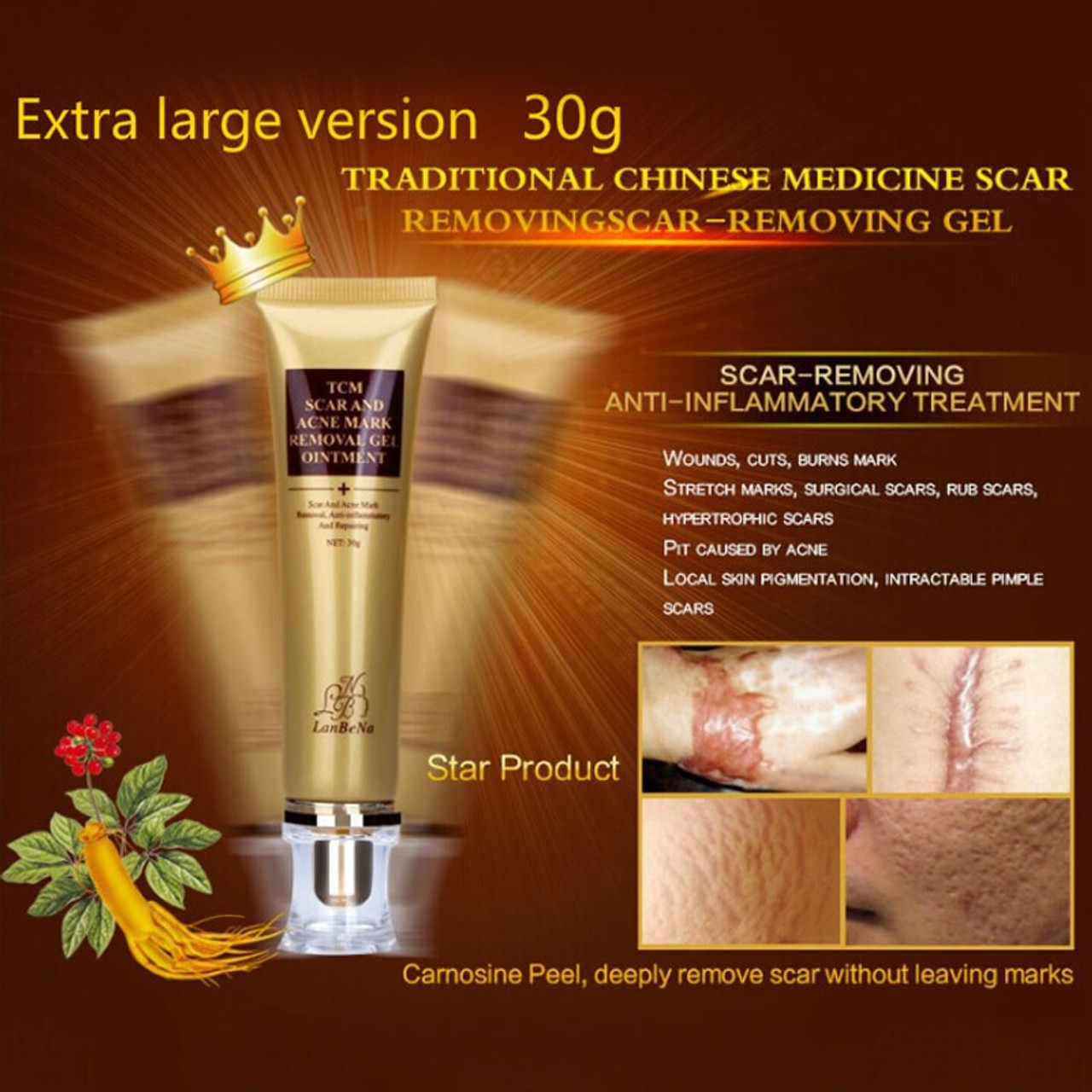 Lanbena 2pcs Acne Scar Removal Serum Cream Stretch Marks Remover Anti Acne Treatment Moisturizing And Nourishing Ginseng Essence Onshopdeals Com