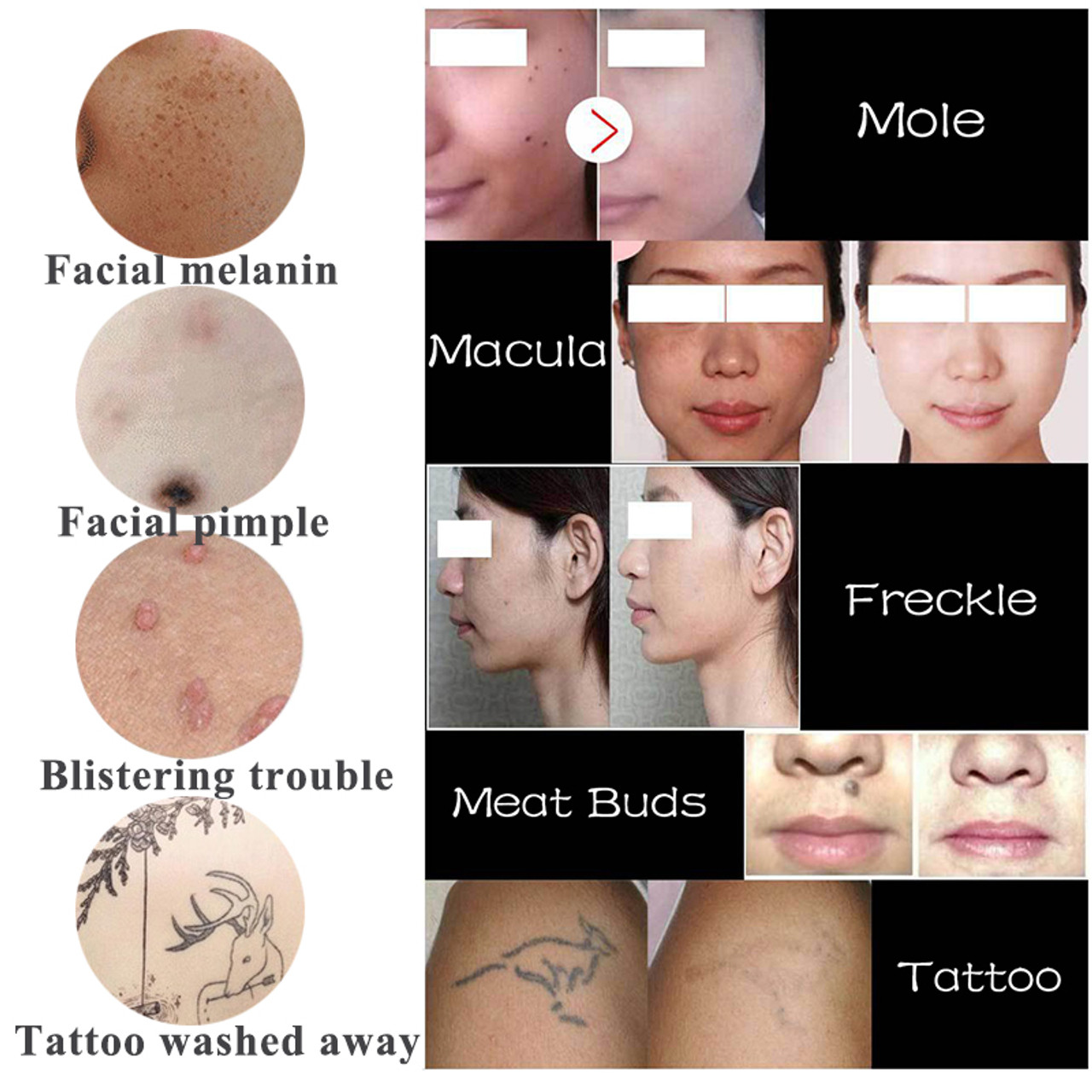 Permanent Beauty Spot Tattoo Mole Tattoo On Chin  YouTube