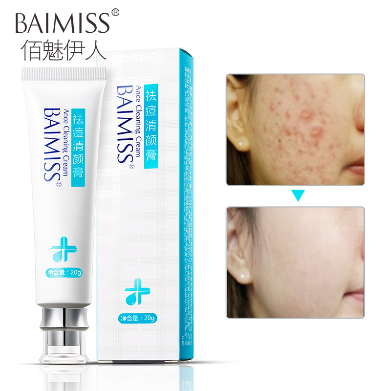 herbal acne treatment cream