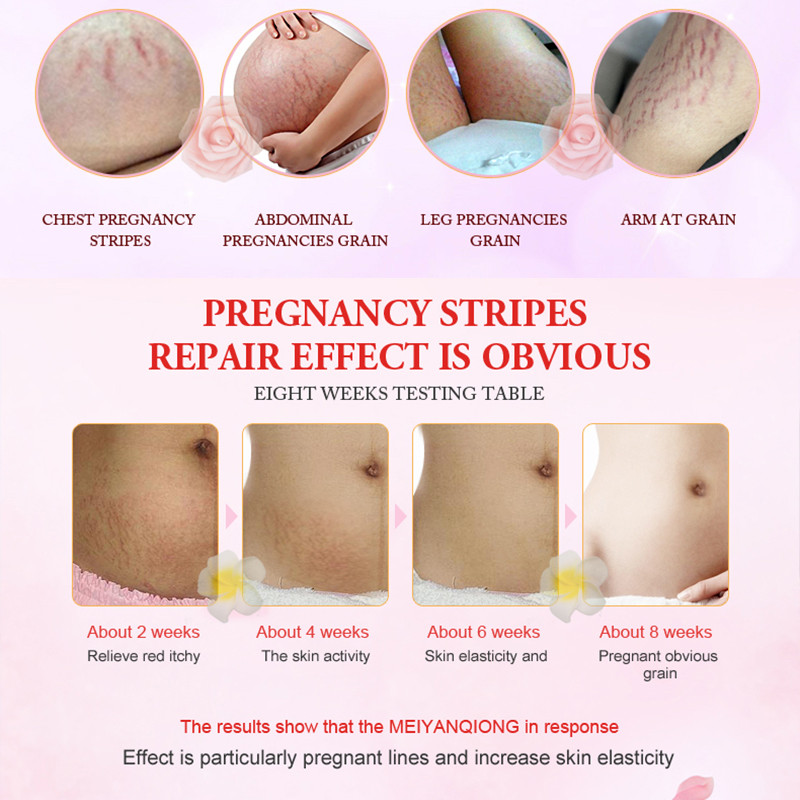 smooth skin repair cream
