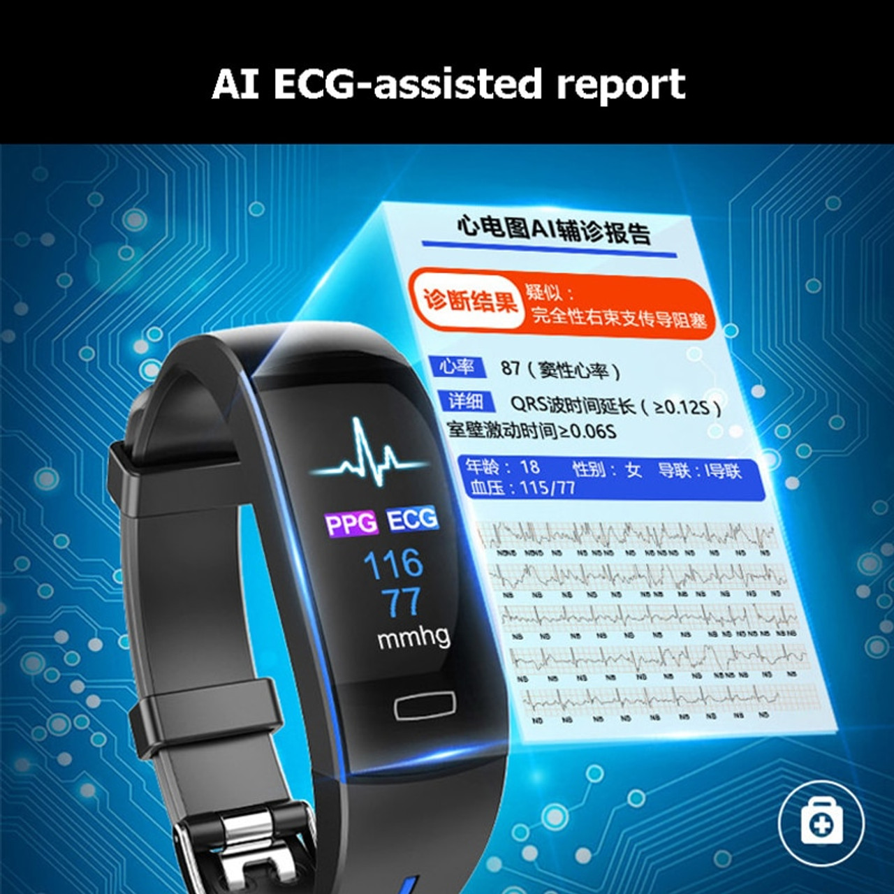xiaomi watch ecg