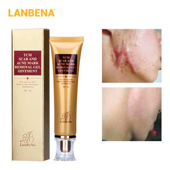 Buy 3 Get 1 Gift LANBENA Acne Scar Removal Cream Skin Repair Face Cream 3pcs+EGF Serum Treatment Blackhead Whitening Skin Care 