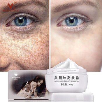 Strong Effects Powerful Whitening Freckle Cream 40g Remove Melasma Acne Spots Pigment Melanin Whitening Moisturizing Skin Care