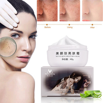 Strong Effects Powerful Whitening Freckle Cream 40g Remove Melasma Acne Spots Pigment Melanin Dark Spots Face Care Cream