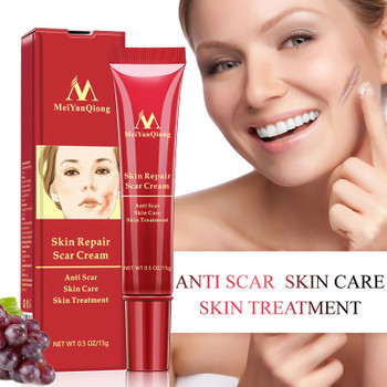 Scar Repair Cream Skin Care Natural Acne Remove Burn Stretch Marks Scar Removal Facial Body Skin Care Repair Cream