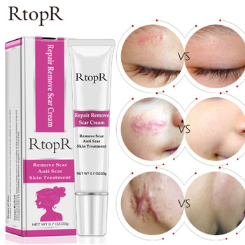 RtopR Acne Scar Stretch Marks Remover Cream Skin Repair Face Cream Acne Spots Acne Treatment Blackhead Whitening Cream Skin Care