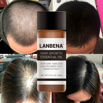  LANBENA 20ml Hair Growth Essence Fast Powerful Hair Care Essential Oil Liquid Treatment Preventing Hair Loss Products for Men
