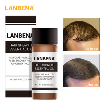  LANBENA 20ml Hair Growth Essence Fast Powerful Hair Care Essential Oil Liquid Treatment Preventing Hair Loss Products for Men