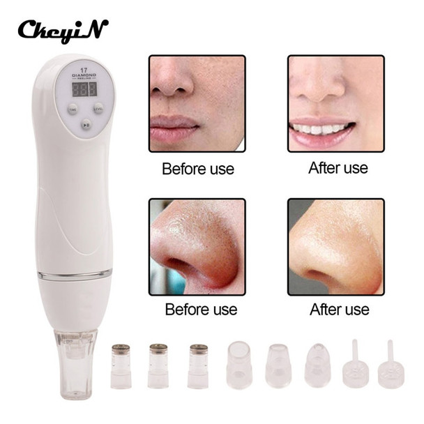 6 Tip Facial Care Beauty Device Skin Diamond Dermabrasion Removal Scar Acne Pore Peeling Machine Care Massager Microdermabrasion