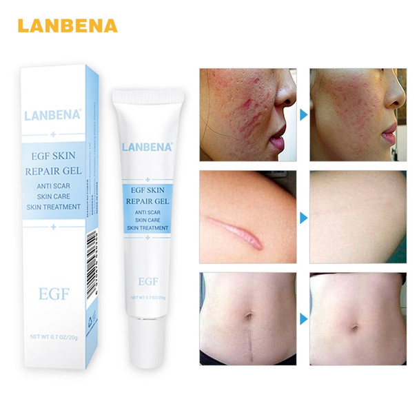 LANBENA face Cream Acne Treatment Gel Acne Cleaning Blackhead Remover Acne Spots Face Acne Scar Skin Care Repair Comedone Pimple