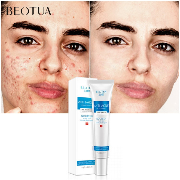 BEOTUA 100% Natural Acne Face Cream Magic Skin Acne Scar Removal Shrink Pores Oil Control Whitening Moisturizing Skin Care