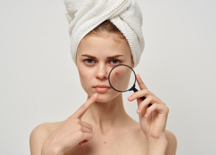 How to Get Rid of Large Pores