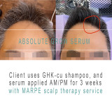 ABSOLUTE GROW SCALP THERAPY SERUM