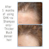 COPPER PEPTIDE GHK-CU CONDITIONER FOR HAIR GROWTH ( ALOPECIA TREAMENT FOR WOMEN)