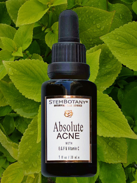 ABSOLUTE ACNE TREATMENT SERUM