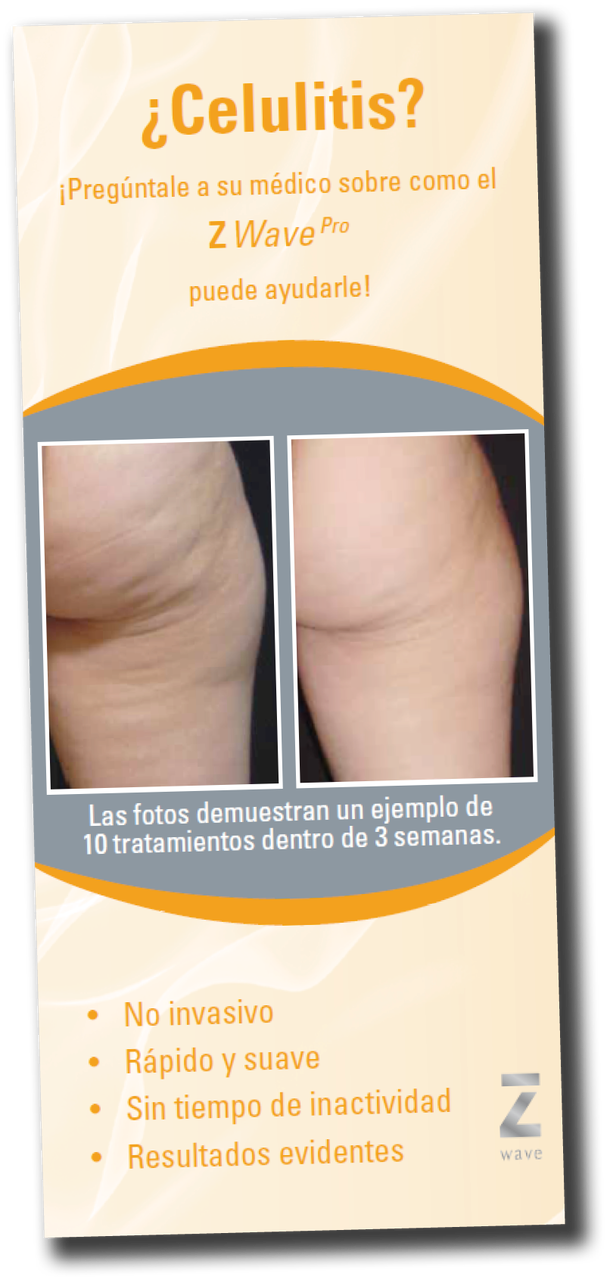 その他 Perfect Cellulite Care Z Wave Pro Waiting Room Brochure – Cellulite - SPANISH | Zimmer
