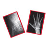 Fixed Bones X-Ray Set