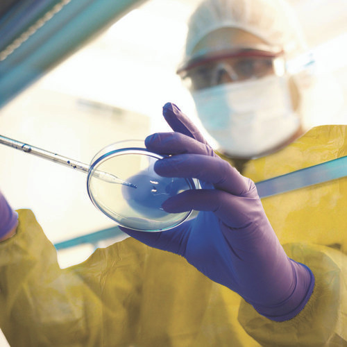 A70 Chemical Spray Protection Smock, One Size Fits Most, Yellow, 25/Carton