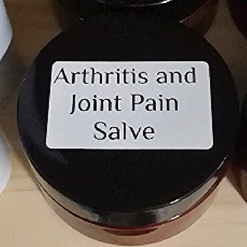 Arthritis joint pain Arthritis joint pain