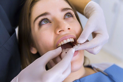 Teeth Night Guards in West Bloomfield, Ann Arbor & Waterford, MI - Dental House Dentist Office