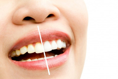Teeth Whitening in West Bloomfield, Ann Arbor & Waterford, MI - Dental House Dentist Office