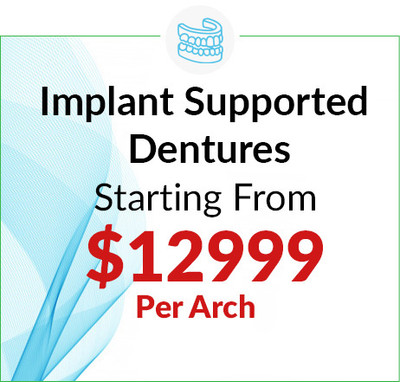 Implant Supported Dentures Starting from $12999 per arch, including Implants implant parts, temporary denture, final denture (not including teeth extraction) in Downriver, West Bloomfield, Ann Arbor & Waterford, MI