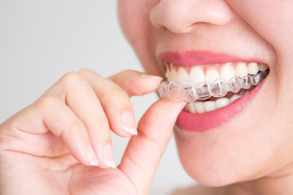 Invisalign® (Clear Aligners) in  Woodhaven Downriver, West Bloomfield, Ann Arbor & Waterford, MI - Dental House Dentist Office