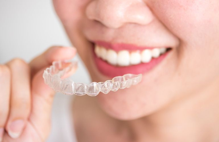 Invisalign - Five Smile Flaws That It Can Fix Invisalign - Five Smile Flaws That It Can Fix