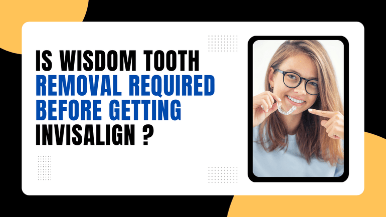 Is Wisdom Tooth Removal Required before Getting Invisalign