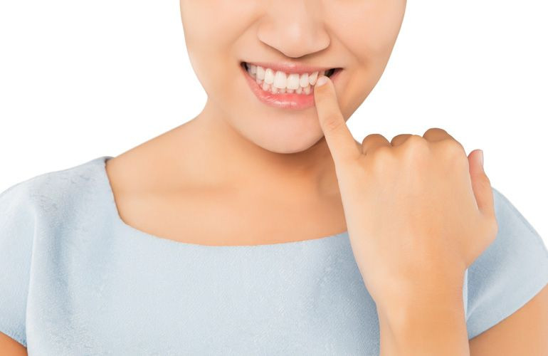 What You Should Know About Receding Gums - Dental Health Guide What You Should Know About Receding Gums - Dental Health Guide